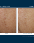 Skinbetter Alpharet Overnight Cream
