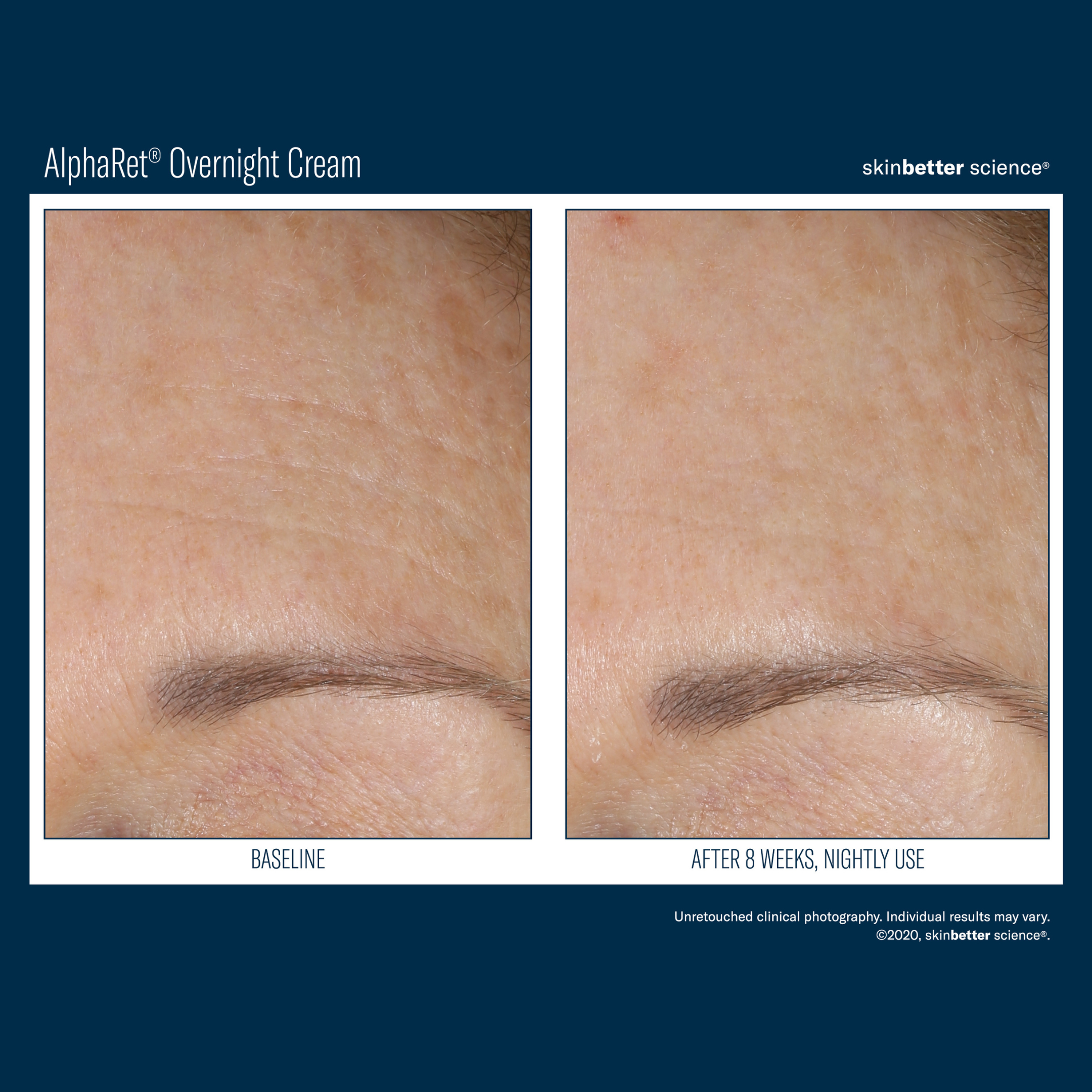 Skinbetter Alpharet Overnight Cream