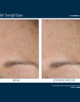 Skinbetter Alpharet Overnight Cream