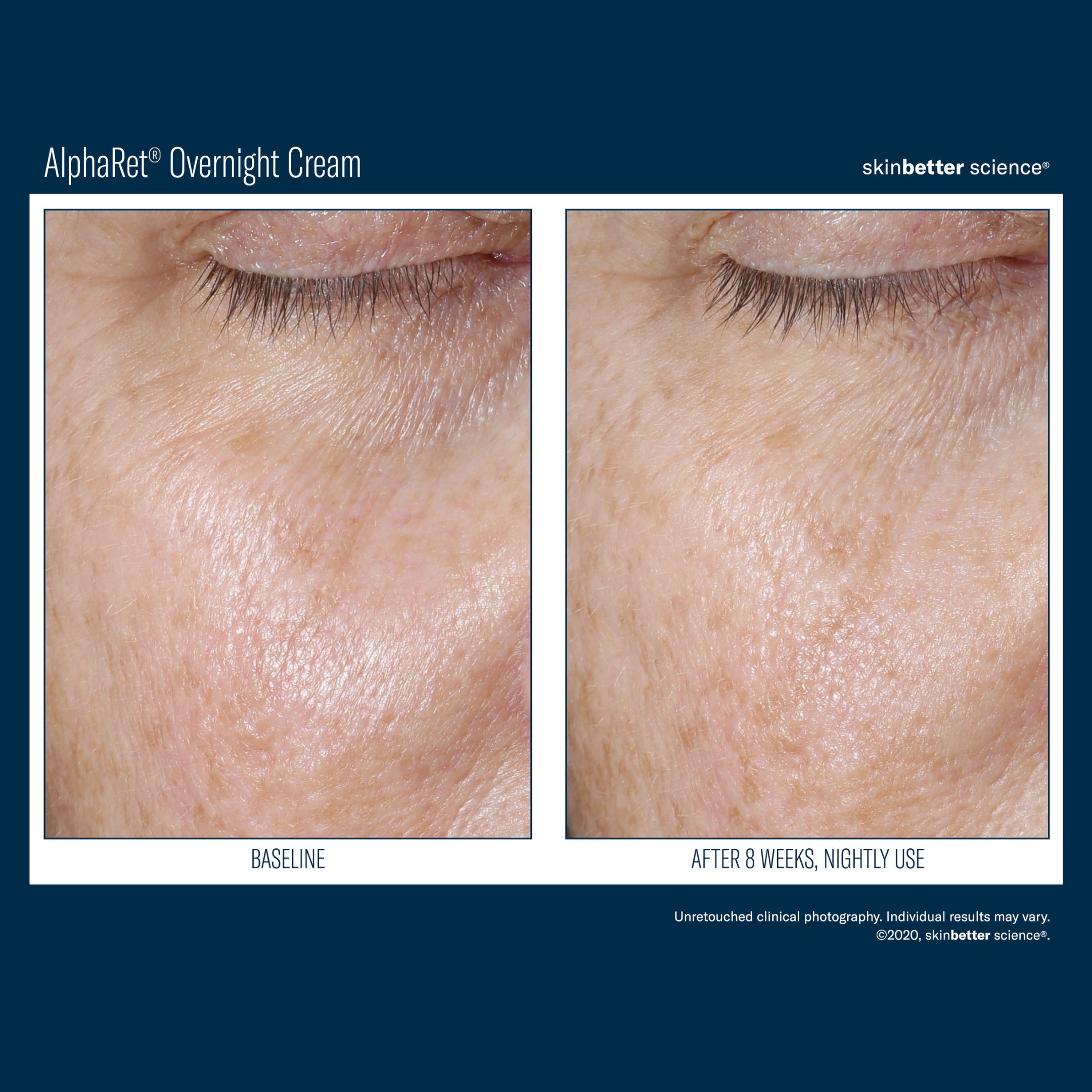 Skinbetter Alpharet Overnight Cream