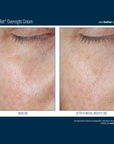 Skinbetter Alpharet Overnight Cream