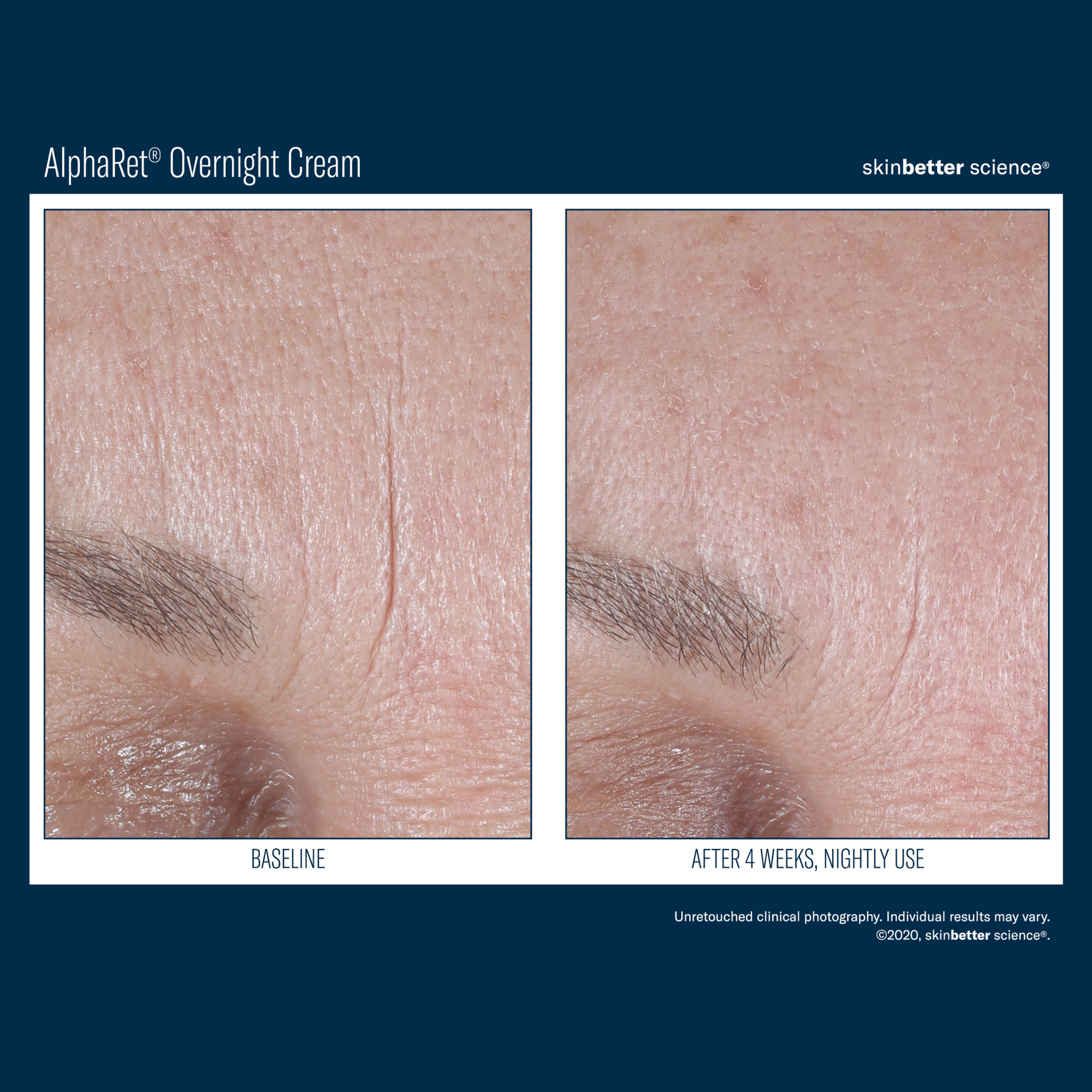 Skinbetter Alpharet Overnight Cream