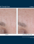 Skinbetter Alpharet Overnight Cream