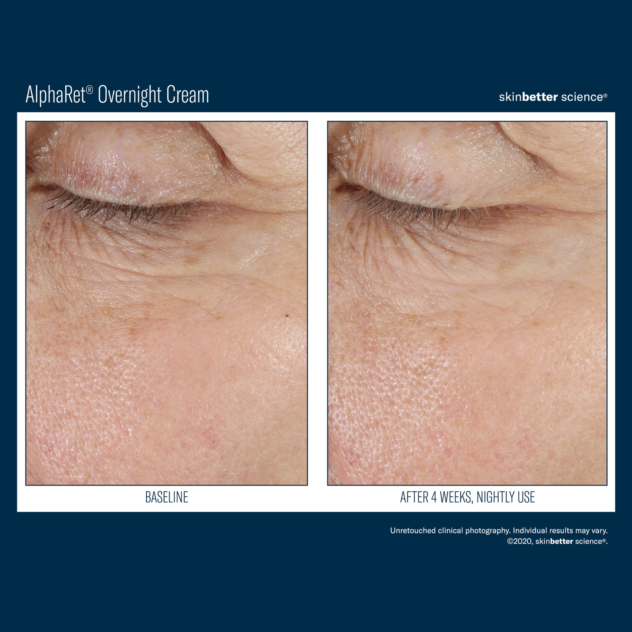 Skinbetter Alpharet Overnight Cream