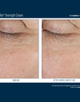Skinbetter Alpharet Overnight Cream