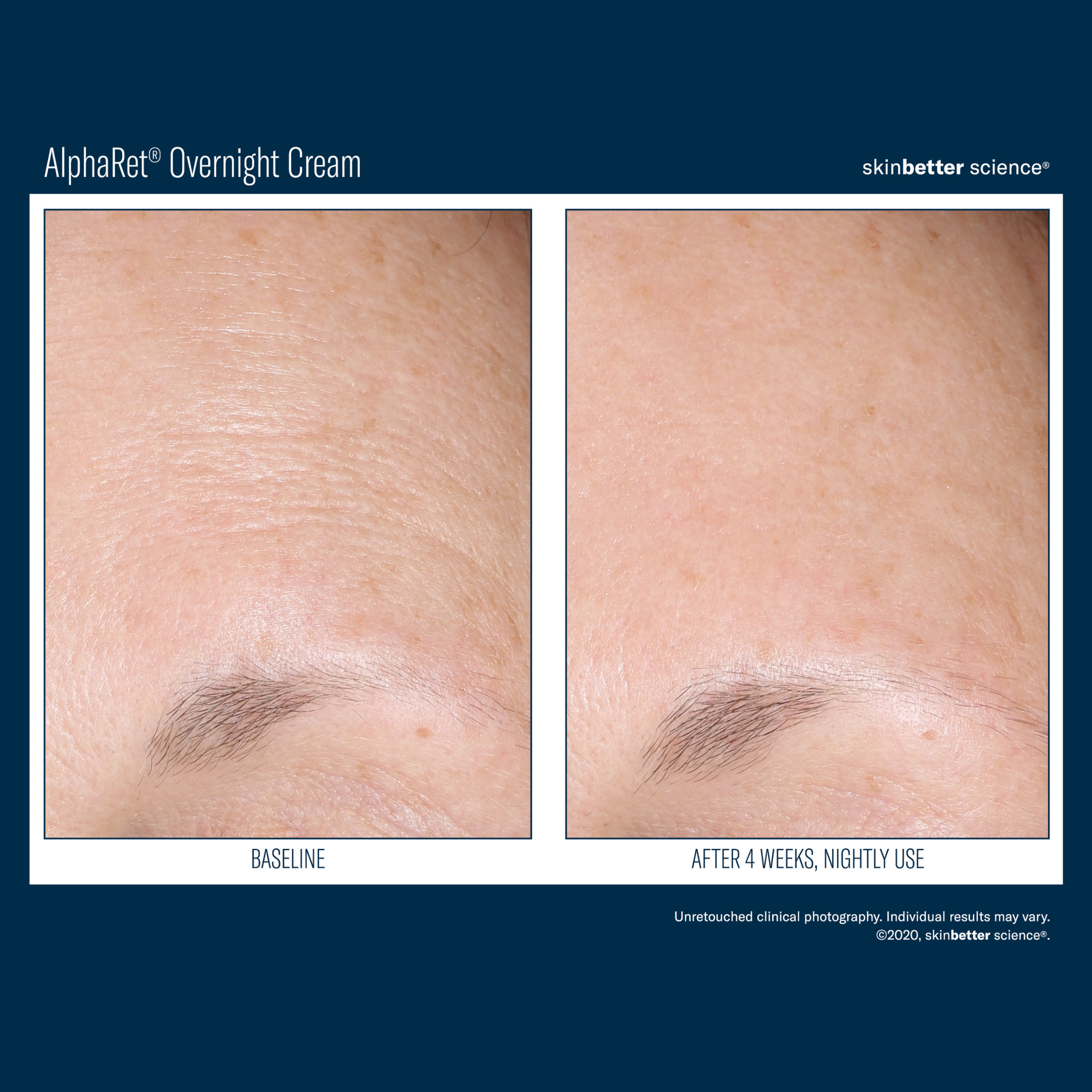 Skinbetter Alpharet Overnight Cream