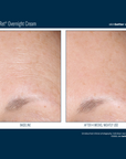 Skinbetter Alpharet Overnight Cream